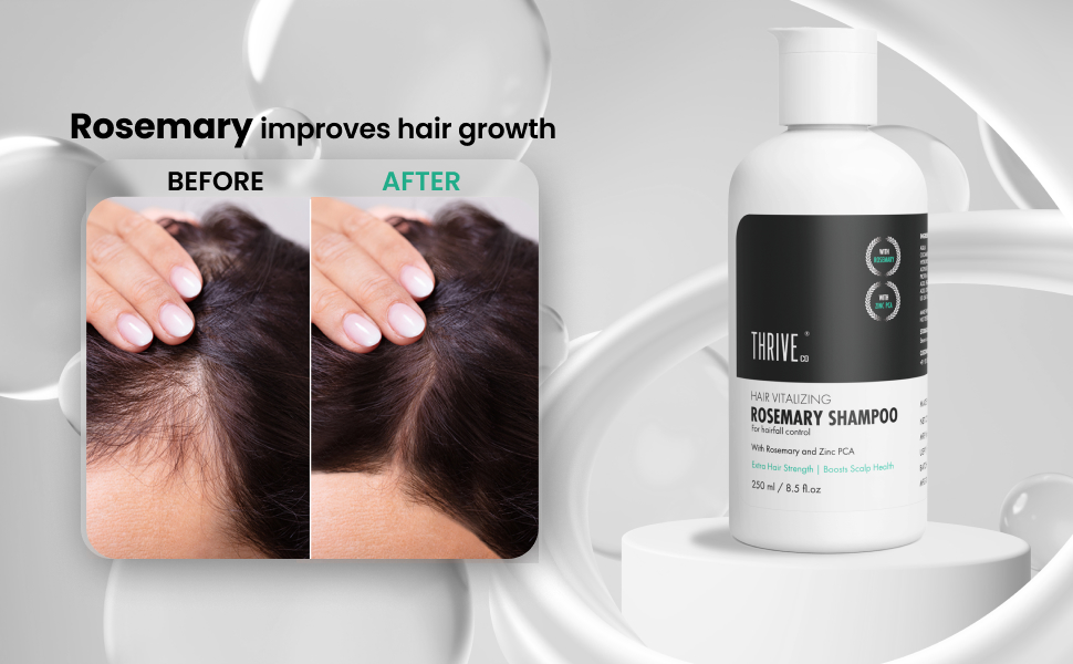 HOW TO CHOOSE THE BEST HAIRFALL control shampoo |thriveco rosemary hairfall control shampoo